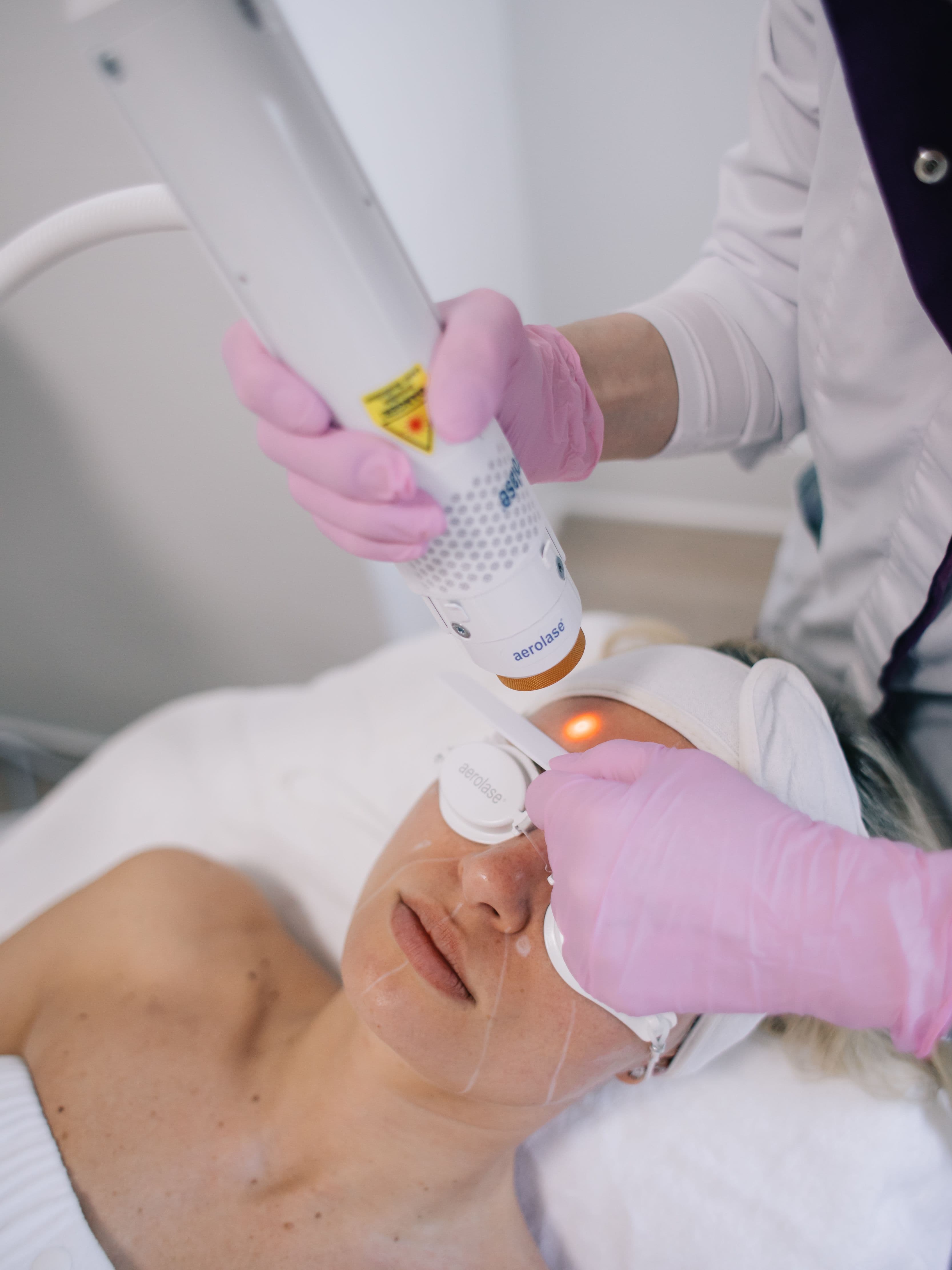 Aerolase Neo Elite in action