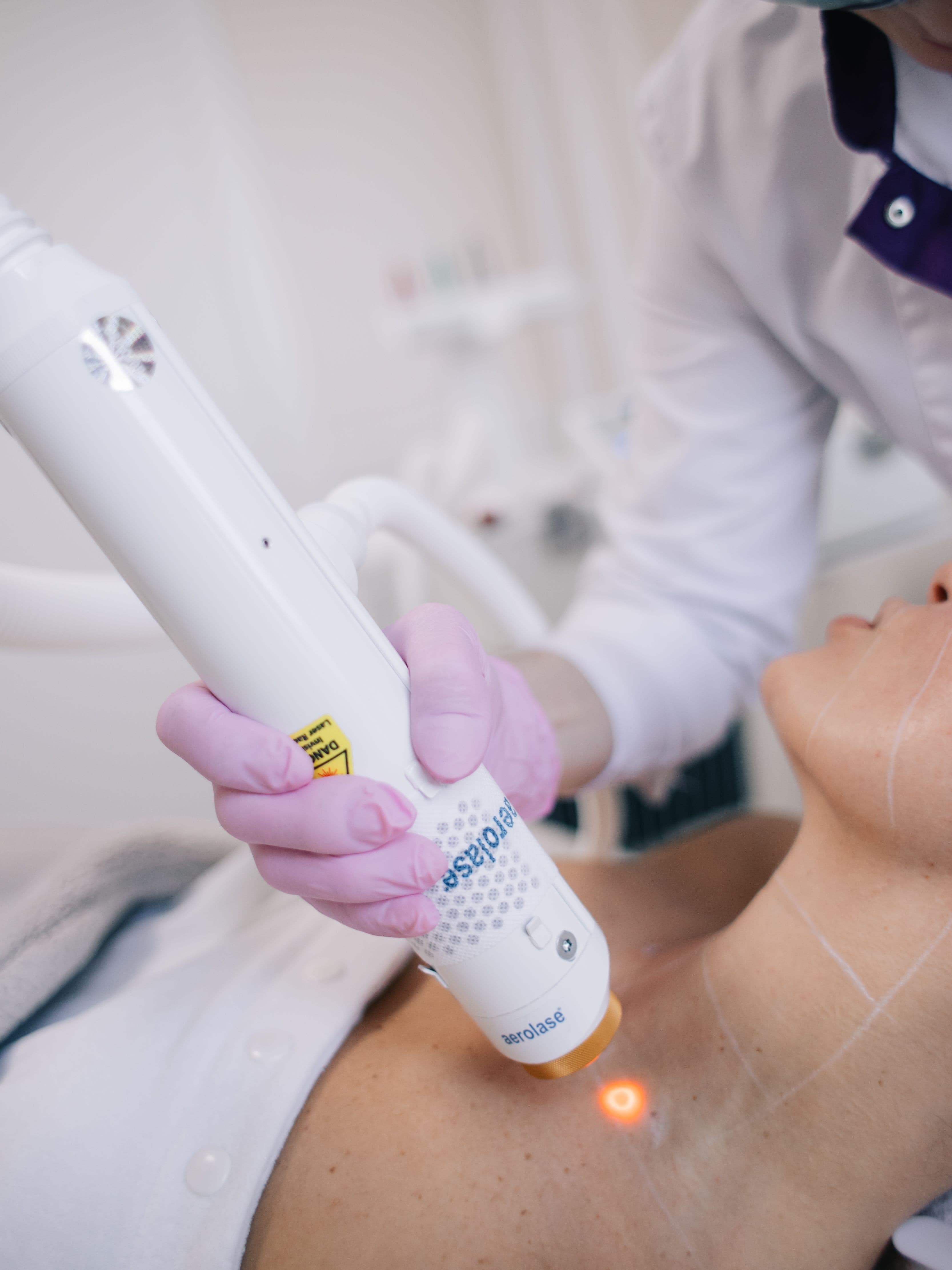 Aerolase Neo Elite in action