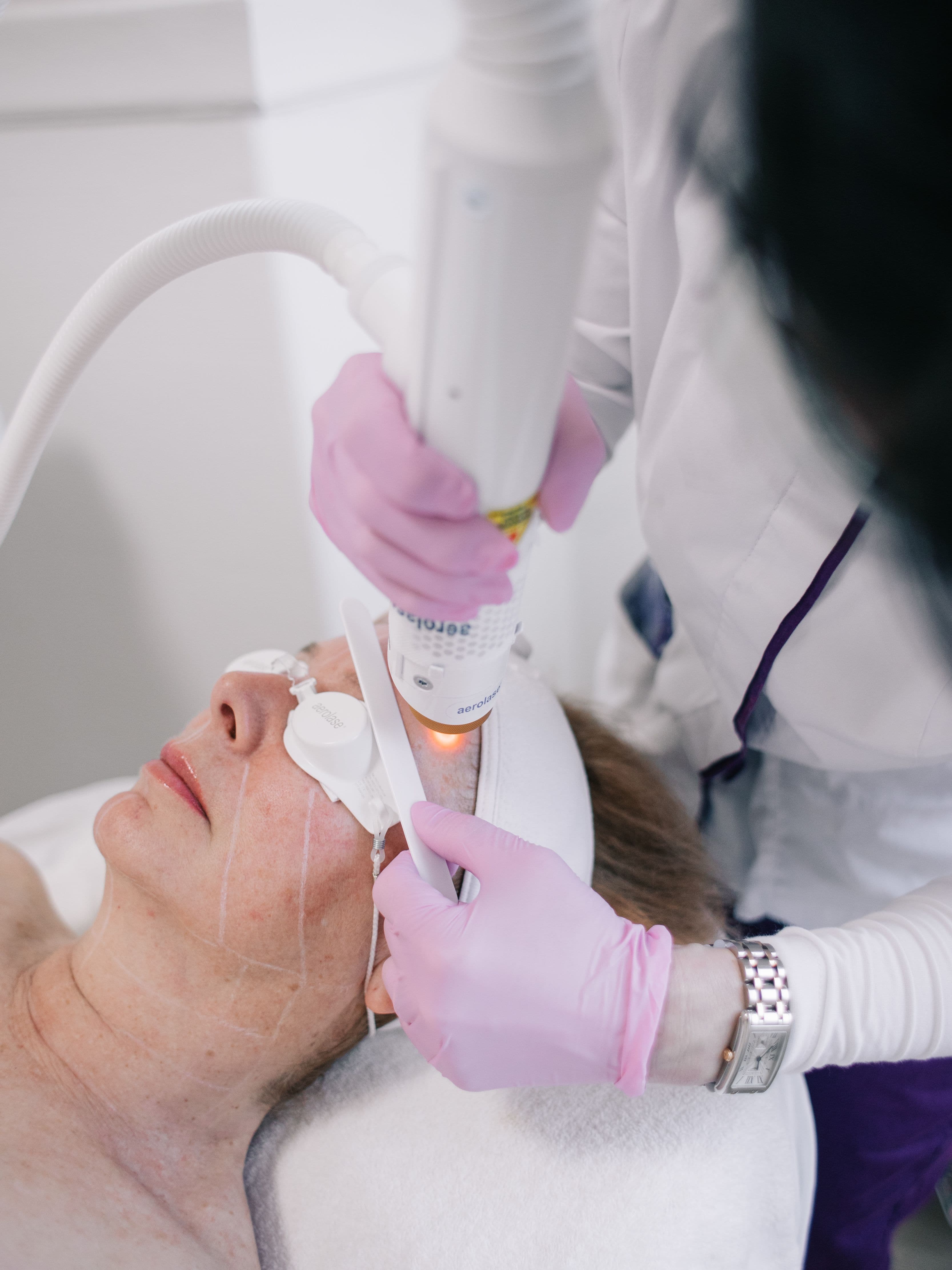 Aerolase Neo Elite in action