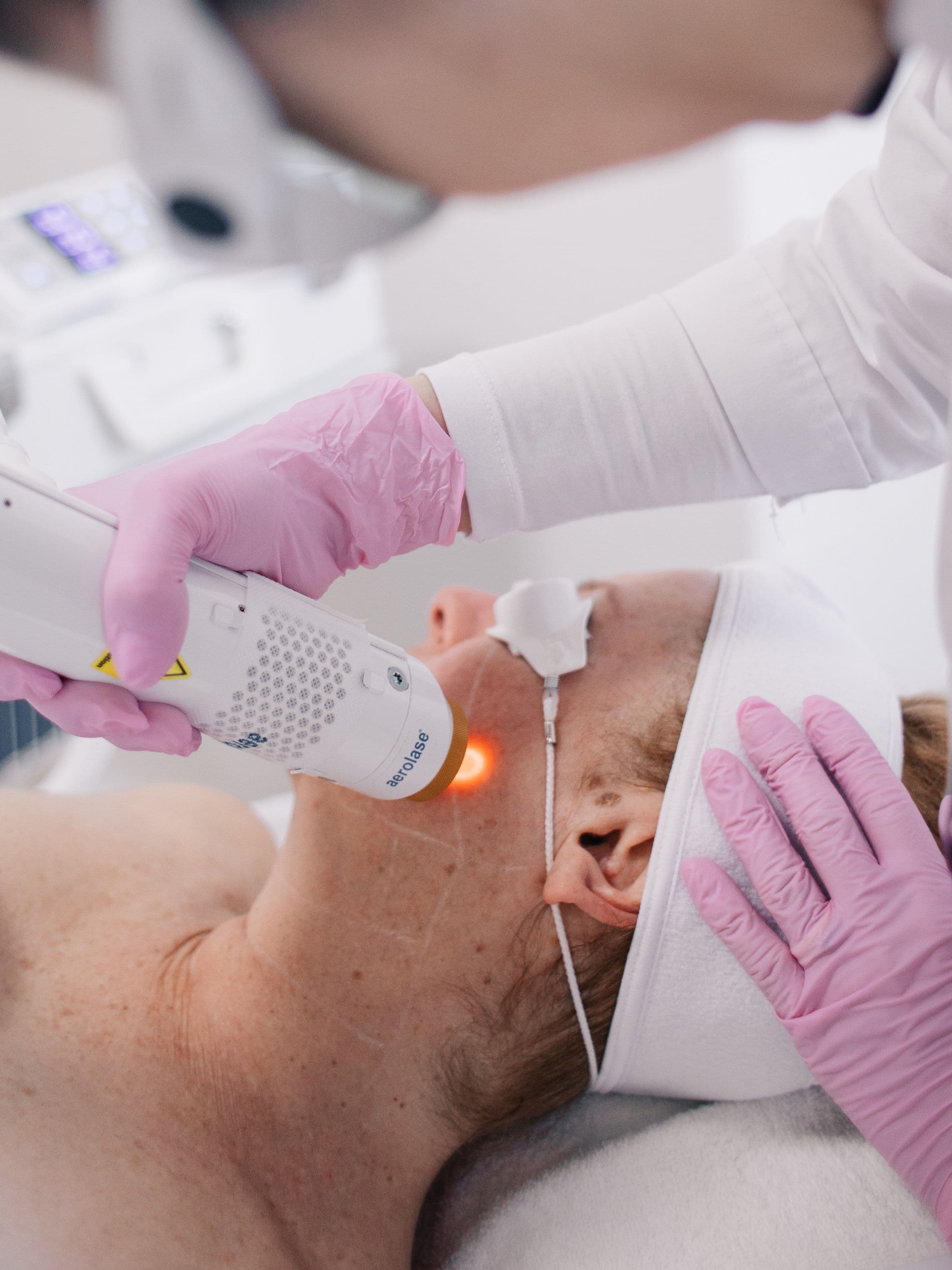 Aerolase Neo Elite in action